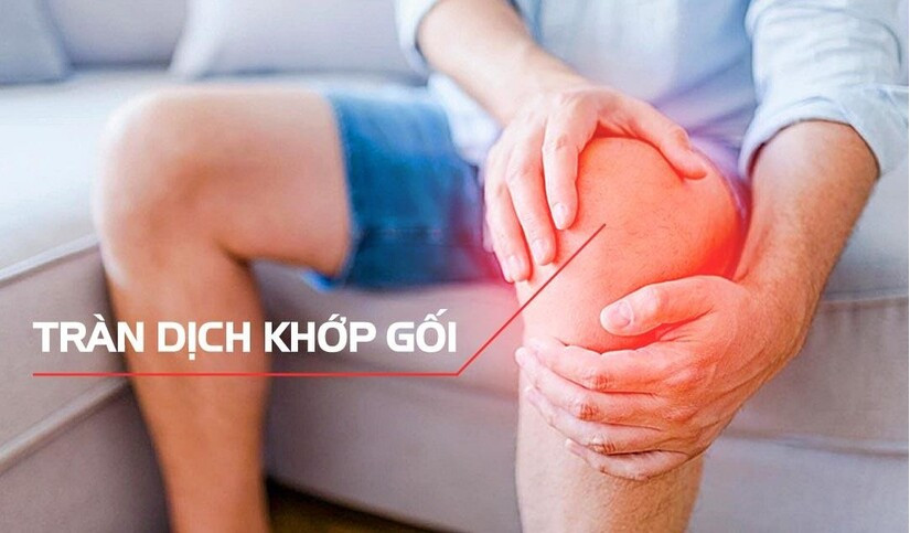 viêm khớp gối tràn dịch