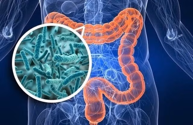 rối loạn tiêu hóa kéo dài ở người lớn