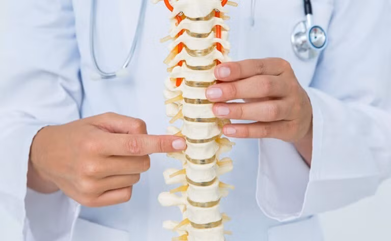 vôi hóa cột sống