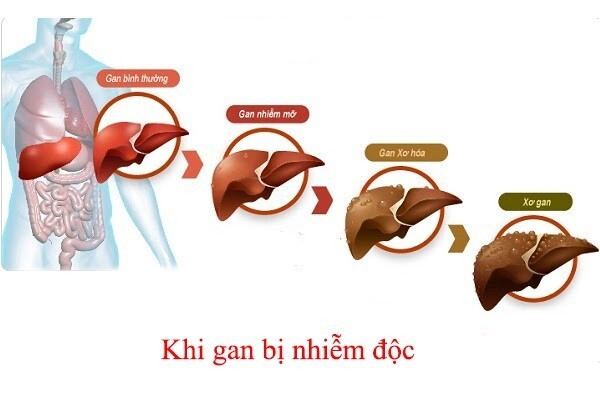 Những ai nên dùng giải độc gan? ảnh 1 giải độc gan Tonka