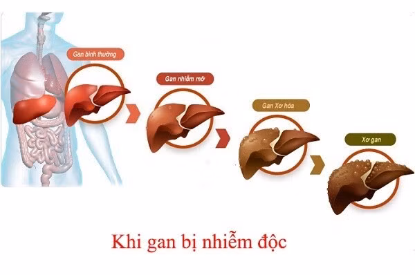 giải độc gan Tonka