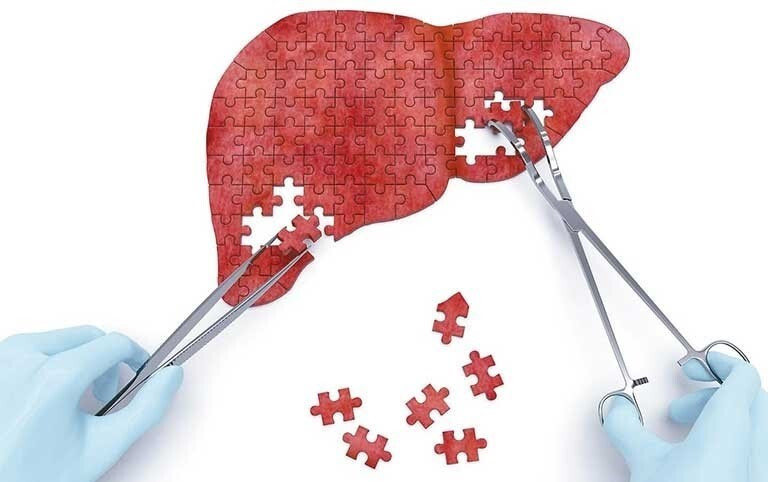 Những ai nên dùng giải độc gan? ảnh 3 giải độc gan Tonka