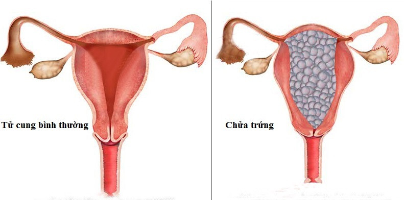que thử thai 2 vạch