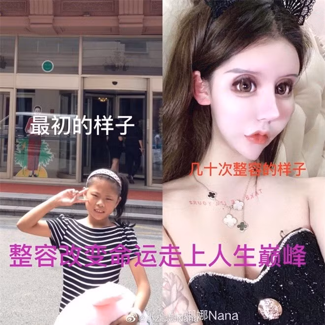 Hình ảnh trước và sau phẫu thuật của 10X Trung Quốc khiến nhiều người ngỡ ngàng.