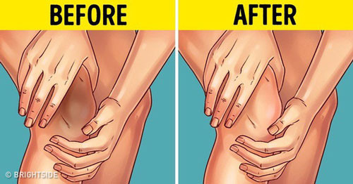 Giấm và sữa chua: Axit axetic trong giấm và axit lactic trong sữa chua sẽ giúp làm sạch đầu gối và khuỷu tay. Trộn 1 muỗng canh sữa chua và 1 muỗng canh giấm táo. Thoa hỗn hợp này lên da. Để yên trong 15 phút và rửa sạch bằng nước ấm. Giấm và sữa chua: Axit axetic trong giấm và axit lactic trong sữa chua sẽ giúp làm sạch đầu gối và khuỷu tay. Trộn 1 muỗng canh sữa chua và 1 muỗng canh giấm táo. Thoa hỗn hợp này lên da. Để yên trong 15 phút và rửa sạch bằng nước ấm.
