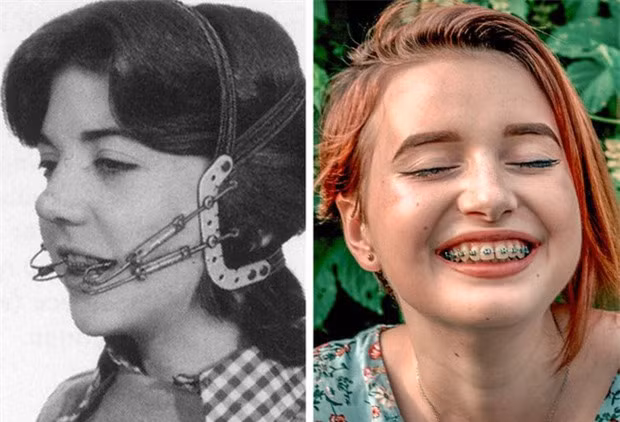 Cận cảnh những phương pháp làm đẹp từ 100 năm trước của chị em phụ nữ, nhiều cái trông không khác gì trong phim kinh dị - Ảnh 12.