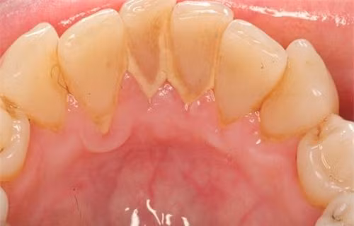 bay-cach-sieu-don-gian-xua-duoi-noi-so-hai-mang-ten-cao-rang