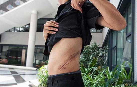 Nam sinh từng gây xôn xao vì bán thận để mua iPhone giờ ra sao? - Ảnh 2