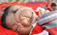 Em bé mới sinh có mũi 