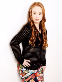 Cô gái Down quyết thay đổi diện mạo và trở thành người mẫu