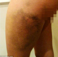 Hãi hùng khi người yêu sao nữ là võ sĩ “côn đồ“ ảnh 3 Hãi hùng khi người yêu sao nữ là võ sĩ “côn đồ“ ảnh 3