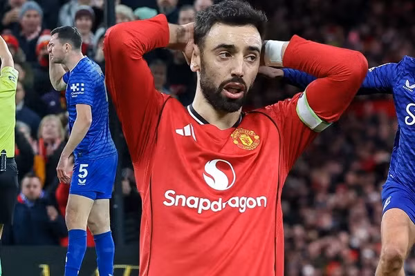 Chùm ảnh: 2 ‘cái tát’ trong trận đấu Man Utd – Everton 