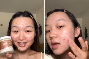 Daniela Martinez bắt đầu kết hợp hạt lanh vào quy trình chăm sóc da của mình sau khi xem video từ những phụ nữ trẻ khác ca ngợi lợi ích của hạt lanh. Ảnh: Daniela Martinez/CNN.