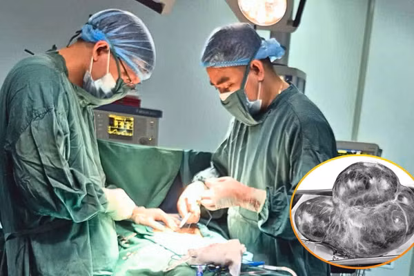 Các bác sĩ thực hiện phẫu thuật, loại bỏ khối u lớn.