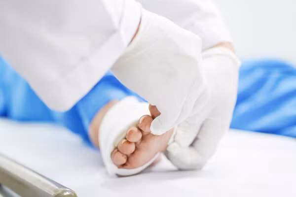 Bàn chân bệnh nhân sau phẫu thuật. (Ảnh: BVCC)