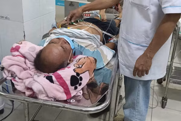 Bệnh nhân được chuyển tuyến đến Bệnh viện Da Liễu TPHCM.