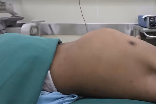 Bệnh nhân trước khi thực hiện phẫu thuật. 