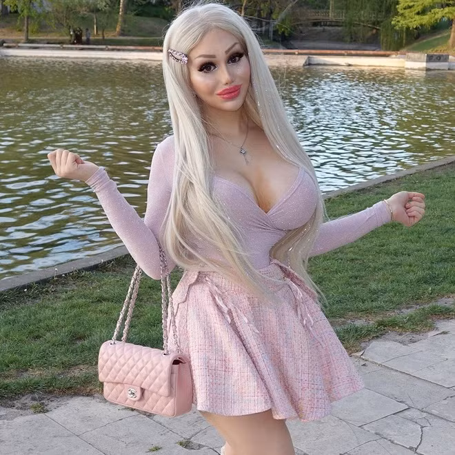 Cô gái chi 170.000 USD, phẫu thuật 10 lần để giống "búp bê Barbie" ảnh 3