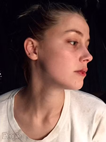 amber heard tung thêm ảnh bằng chứng tố johnny depp bạo hành hình 2 amber heard tung them anh bang chung to johnny depp bao hanh hinh 2