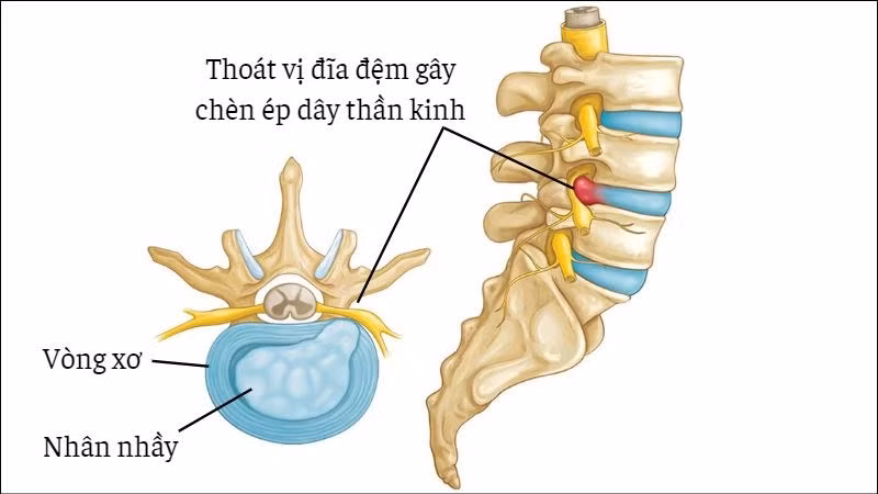 Ảnh minh họa: ITN Ảnh minh họa: ITN