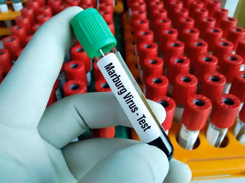Virus Marburg gây ra các triệu chứng sốt xuất huyết. Ảnh: India Times. Virus Marburg gây ra các triệu chứng sốt xuất huyết. Ảnh: India Times.