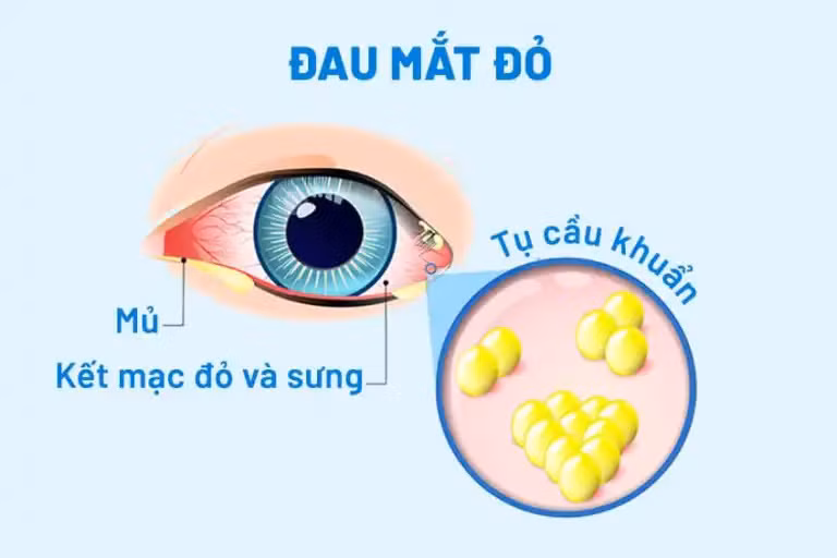 Ảnh minh họa: ITN