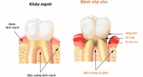 Minh họa/INT Minh họa/INT