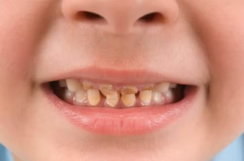 Lý giải nguyên nhân khiến răng ố vàng, tóc gãy rụng ảnh 1