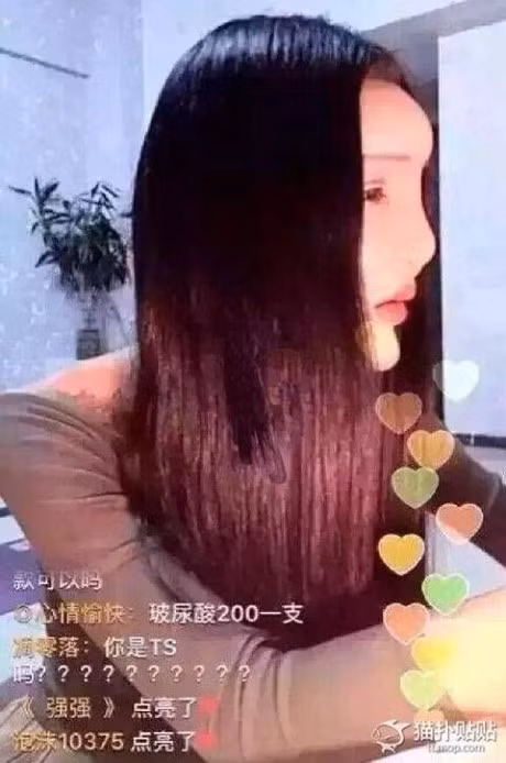 Co gai phau thuat tham mi bi che giong loai ca xau nhat the gioi - Anh 5