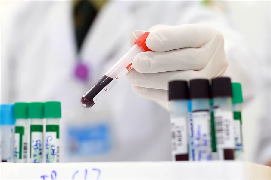 Ảnh minh họa.
