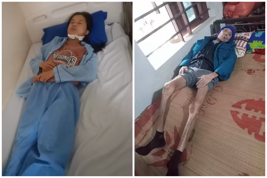 Gặp tai nạn nhưng vì bố bệnh nặng bệnh viện trả về nên gia đình cũng xin đưa Trúc về nhà để theo dõi. (Ảnh: P.C)
