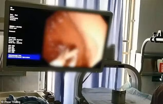 Người phụ nữ đã hồi phục và được xuất viện.