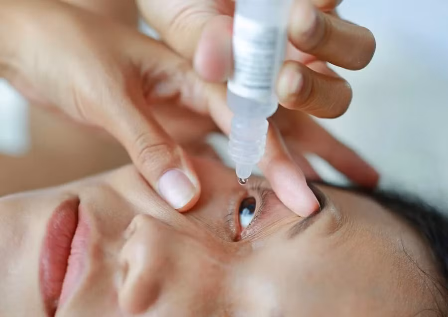 Việc dùng nước mắt nhân tạo không kê đơn hoặc thuốc nhỏ nước muối có thể làm dịu triệu chứng đau mắt đỏ. Ảnh minh họa