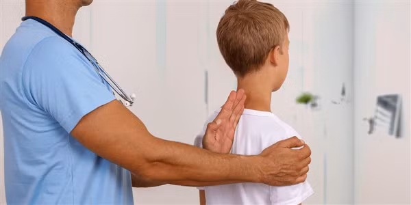 Vẹo cột sống ở trẻ khó được phát hiện sớm.