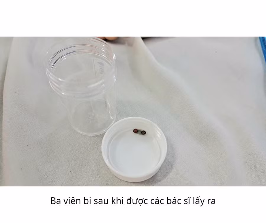 Ảnh: BV. Ảnh: BV.