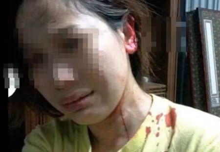 Dân mạng dậy sóng vì hình ảnh vợ bị chồng cắn tai, cắt tóc