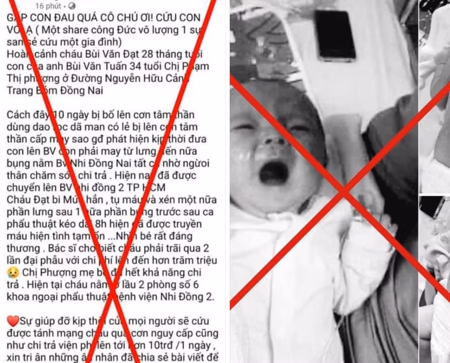 Thông tin kêu gọi hỗ trợ bệnh nhi trên mạng xã hội. Ảnh: BV.