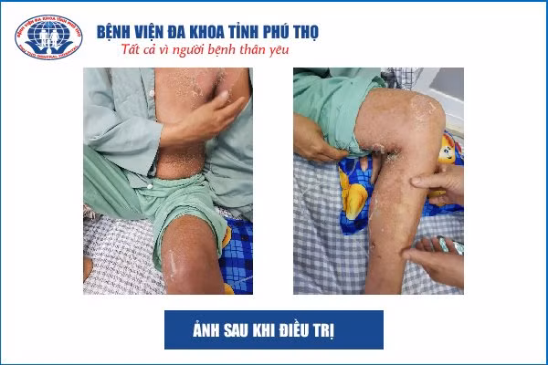 Nguồn: BV.