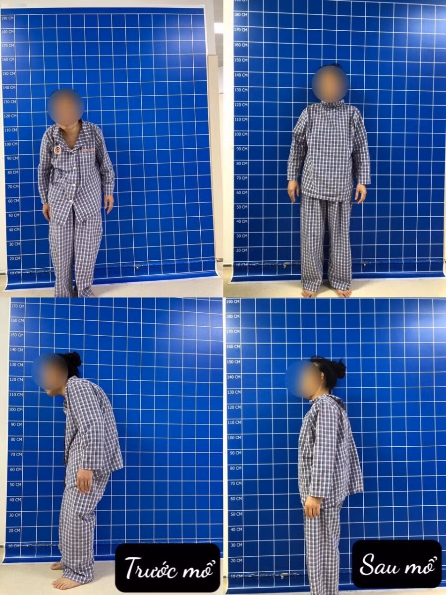 Nguồn: BV.