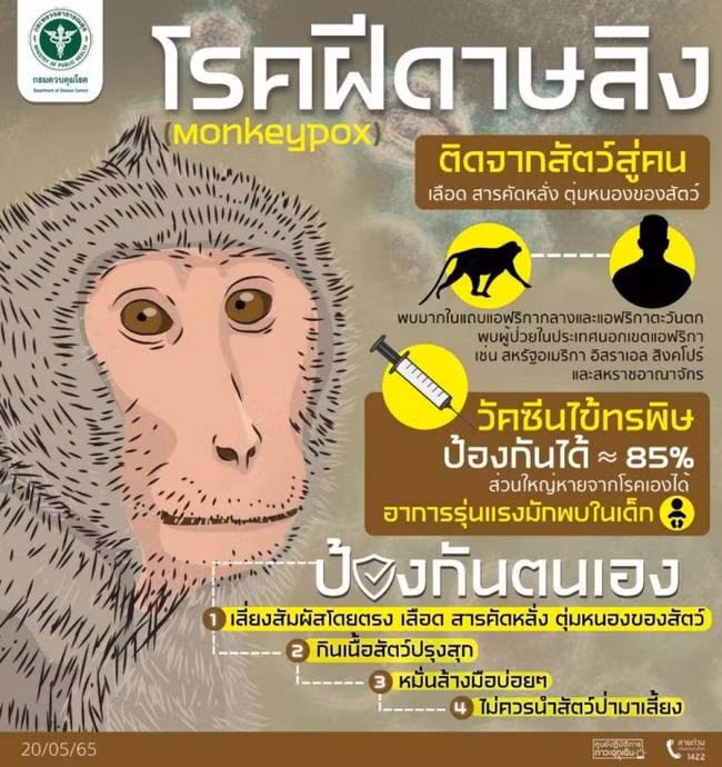 Cảnh báo lây nhiễm bệnh đậu mùa khỉ ở Thái Lan. Ảnh: ThaiPBS.