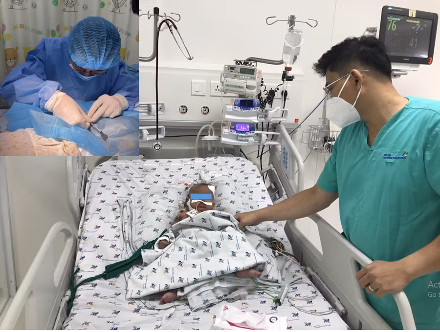 Trẻ được bộc lộ tĩnh mạch để truyền dịch, truyền máu, chế phẩm máu, kháng sinh, kháng giun, hỗ trợ hỗ hấp tuần hoàn, tình trạng cải thiện dần, tỉnh táo cai máy thở. Ảnh: BV. Trẻ được bộc lộ tĩnh mạch để truyền dịch, truyền máu, chế phẩm máu, kháng sinh, kháng giun, hỗ trợ hỗ hấp tuần hoàn, tình trạng cải thiện dần, tỉnh táo cai máy thở. Ảnh: BV.