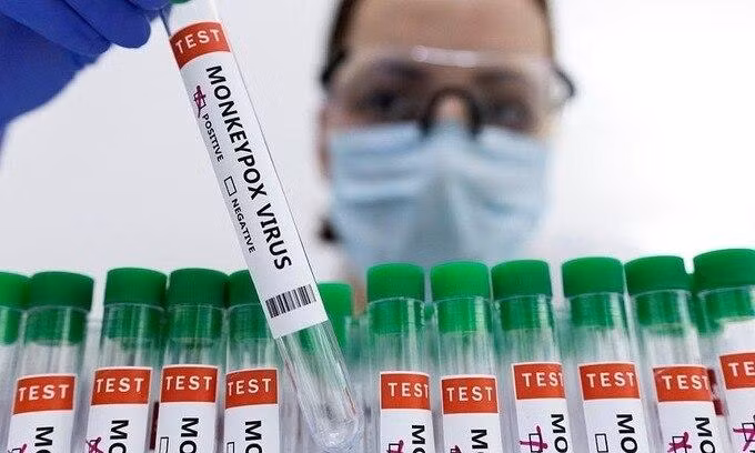 Bộ Y tế đã chủ động chỉ đạo các Viện Vệ sinh dịch tễ/ Viện Pasteur, Sở Y tế các tỉnh, thành phố triển khai các biện pháp sẵn sàng dự phòng đáp ứng với dịch bệnh đậu mùa khỉ.