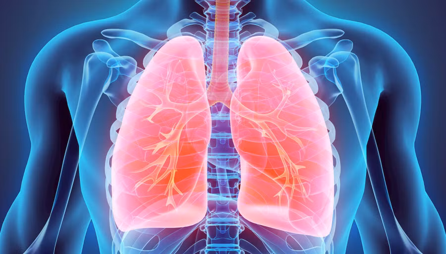 Lupus ban đỏ có thể dẫn đến các biến chứng nguy hiểm trên phổi. Ảnh minh họa
