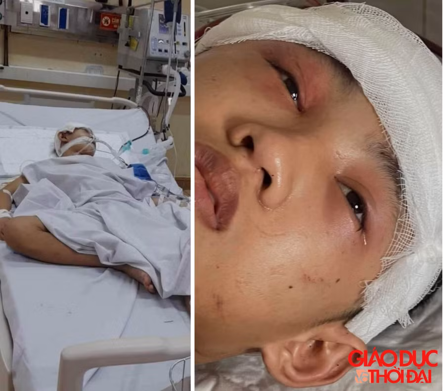 Từ một chàng trai ngoan ngoãn, hiếu thảo, em Trần Đình Núi giờ nằm bất động, sự sống hết sức mong manh.