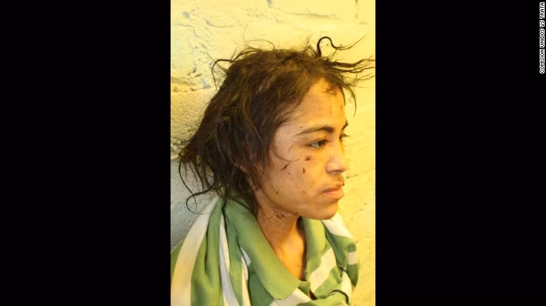 Cô gái bị bỏ đói, xích cổ, dí sắt nóng vào người, hành hạ man rợ như thời trung cổ ảnh 1