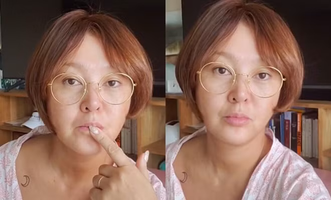 Lee Seung Yeon lộ da thật xuống cấp trầm trọng.