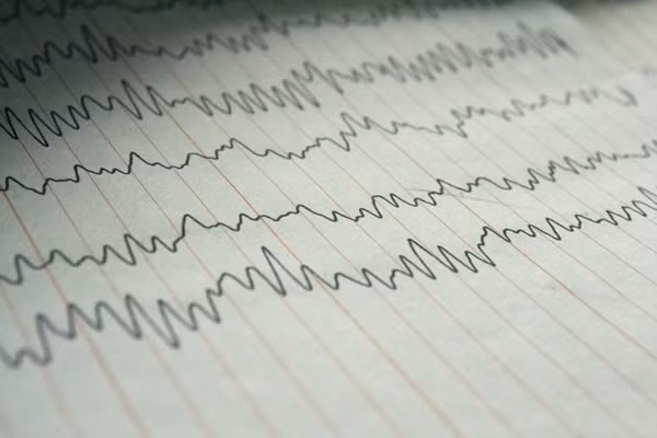 Điện não đồ cho thấy hoạt động của não.