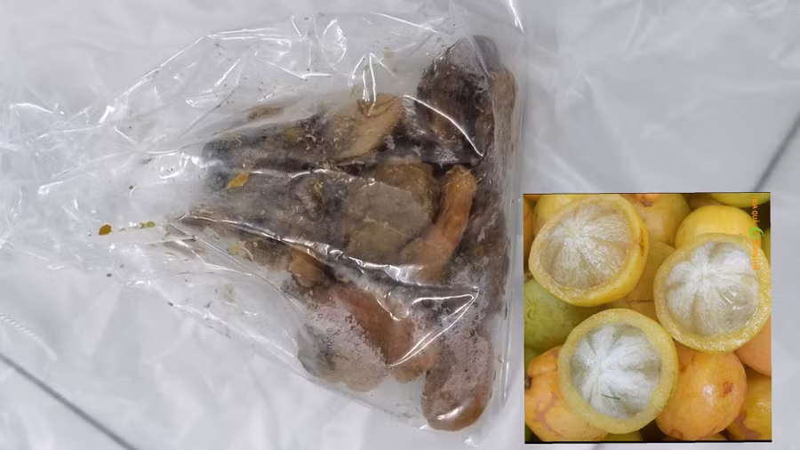 Hạt quả bứa được lấy ra từ bụng bệnh nhân. Ảnh: BVCC.