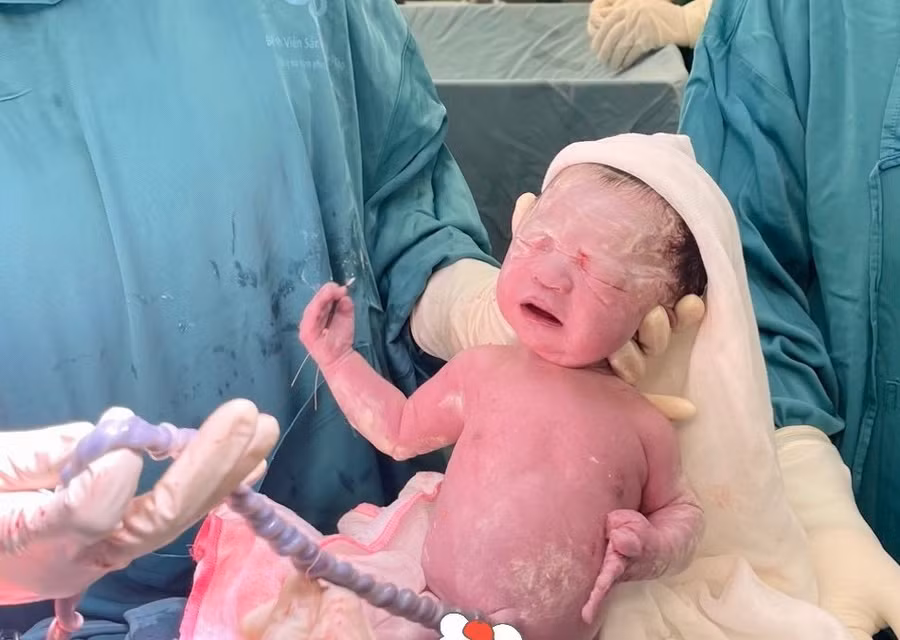 Sức khỏe của 2 em bé bình thường, đây là trường hợp trùng hợp hi hữu tại Bệnh viện Sản Nhi Phú Thọ.