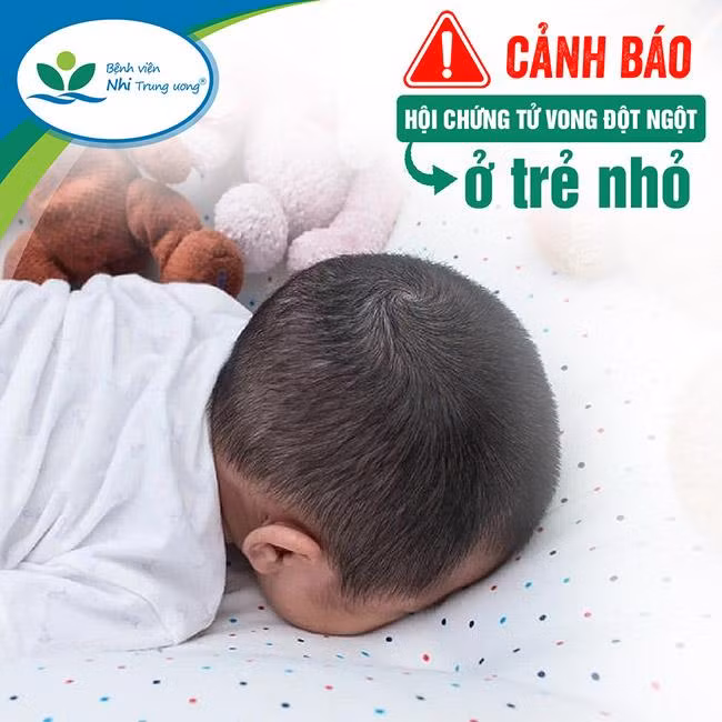 Ảnh: BV Nhi Trung ương. Ảnh: BV Nhi Trung ương.